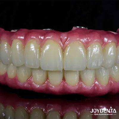 Lichte tandheelkundige titanium Malong Hybride brug Comfortabel voor tandheelkundige restauratie