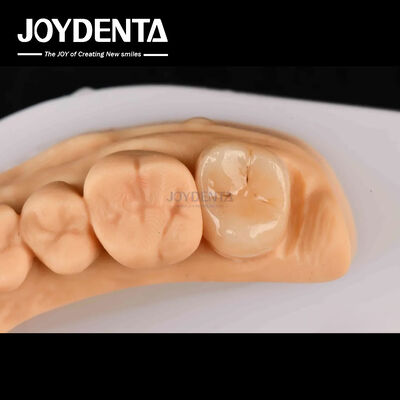 Hoge sterkte Emax Inlay Onlay A2 Kleur Langdurig Voor beschadigde tanden Herstel