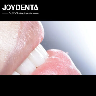 Langdurig tandheelkundig composiet veneer Goede biocompatibiliteit Geen afval van porselein veneers