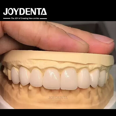 16 schakeringen Kleur Emax Tandheelkundige veneers A1-A4 Hoge vlekbestendigheid voor een perfecte glimlach